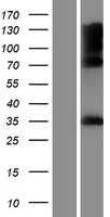 IYD Human Over-expression Lysate