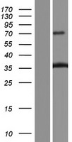 Collagen XI alpha 2 (COL11A2) Human Over-expression Lysate