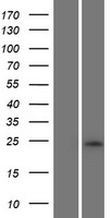 RNF222 Human Over-expression Lysate