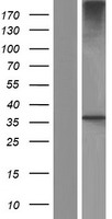 GNB3 Human Over-expression Lysate