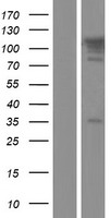 TBC1D2B Human Over-expression Lysate