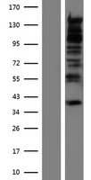 RBM27 Human Over-expression Lysate