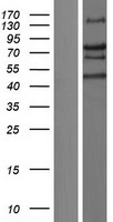 TRIM66 Human Over-expression Lysate