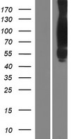 Cortactin (CTTN) Human Over-expression Lysate