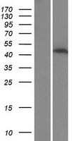 PPP1R3G Human Over-expression Lysate