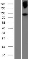 NELL2 Human Over-expression Lysate