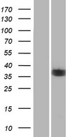 NEK6 Human Over-expression Lysate