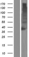 TM6SF1 Human Over-expression Lysate