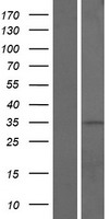 CCDC42B (CFAP73) Human Over-expression Lysate