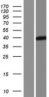 RPUSD4 Human Over-expression Lysate