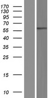 ACOXL Human Over-expression Lysate