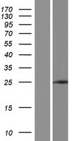 ZNF780A Human Over-expression Lysate