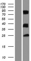 LGALS12 Human Over-expression Lysate