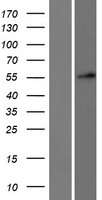 DKC1 Human Over-expression Lysate