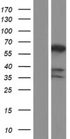 PPP3CB Human Over-expression Lysate