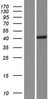 CCDC113 Human Over-expression Lysate