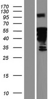 DACH2 Human Over-expression Lysate
