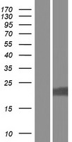 LYSMD1 Human Over-expression Lysate