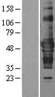 ZNF843 Human Over-expression Lysate