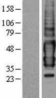 TPRA1 Human Over-expression Lysate