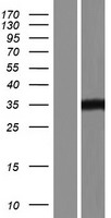 HDAC11 Human Over-expression Lysate