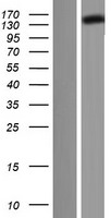 DCTN1 Human Over-expression Lysate