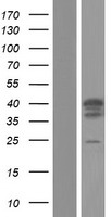 TRIM17 Human Over-expression Lysate