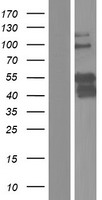 PBX3 Human Over-expression Lysate