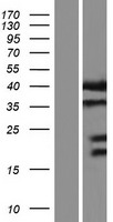 Syntaxin 16 (STX16) Human Over-expression Lysate
