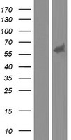 MEF2A Human Over-expression Lysate