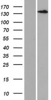 LTBP3 Human Over-expression Lysate
