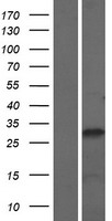 SETBP1 Human Over-expression Lysate