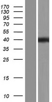 ELMOD1 Human Over-expression Lysate