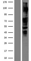 PAK1 Human Over-expression Lysate