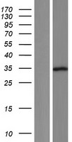 NUDT22 Human Over-expression Lysate