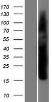 Vgl4 (VGLL4) Human Over-expression Lysate