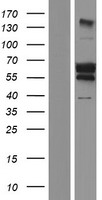 Upstream Binding Protein 1 (UBP1) Human Over-expression Lysate