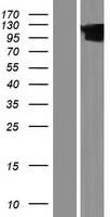 VPS53 Human Over-expression Lysate