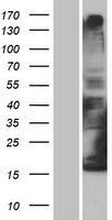 Cytochrome b reductase 1 (CYBRD1) Human Over-expression Lysate