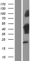 Tuftelin 1 (TUFT1) Human Over-expression Lysate