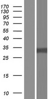 HDGF Human Over-expression Lysate