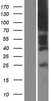 DARC (ACKR1) Human Over-expression Lysate