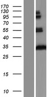 HCCS Human Over-expression Lysate