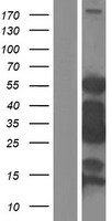 SMTNL2 Human Over-expression Lysate