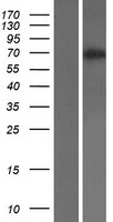 CD105 (ENG) Human Over-expression Lysate