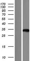 ASPDH Human Over-expression Lysate