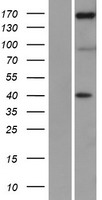 NFAT5 Human Over-expression Lysate