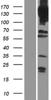 PDE4A Human Over-expression Lysate