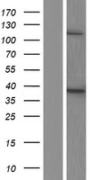 Tartrate Resistant Acid Phosphatase (ACP5) Human Over-expression Lysate