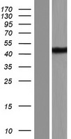 TDRD12 Human Over-expression Lysate